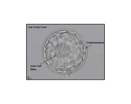 台湾做试管婴儿要多少钱？具体费用是多少？