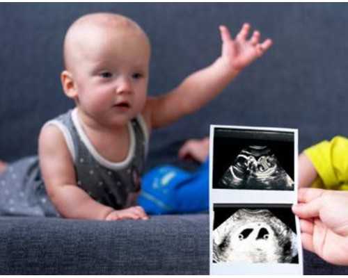 哪里可以包生男孩_代生全包多少钱,南通中医药大学附属第三医院可以做供卵试