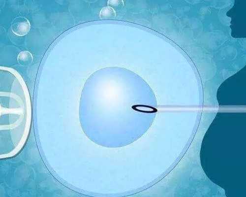 代孕公司哪家更靠谱-代孕费用明细,AMH检查重要吗?高龄试管婴儿前为什么要看