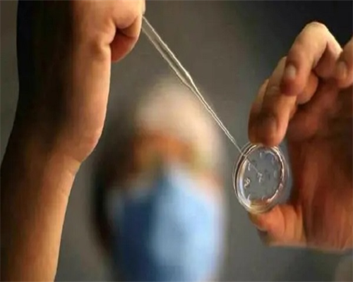 子宫肌瘤:了解其典型症状及其健康影响