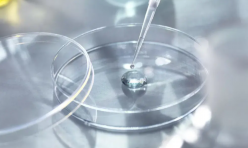 子宫肌瘤的神秘起源：揭开女性生殖健康的秘密