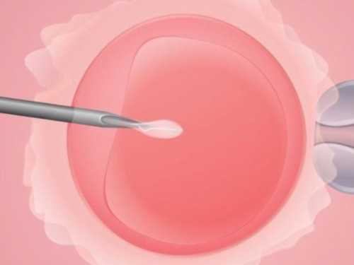 国内供卵哪家靠谱_试管代孕一定能成功吗,
              移植后要不要做经皮贴帮