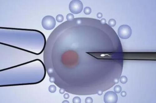 宫颈糜烂的初期表现：了解并防范