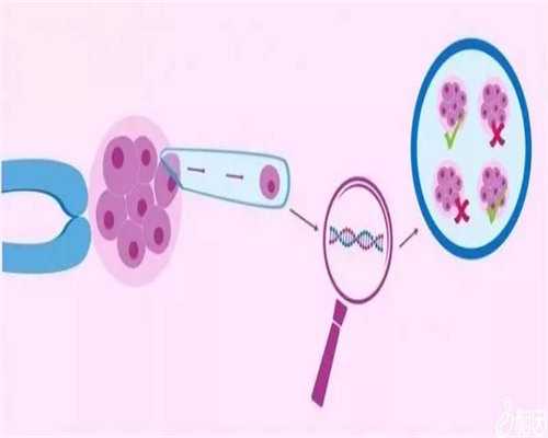 子宫肌瘤：症状、因及治疗方案的深入解读