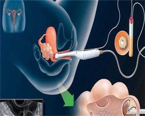 警惕!盆腔炎的症状可能藏匿在这些症状之中