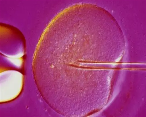 代孕黑色产业链:中介超400家, 费用40万至135万