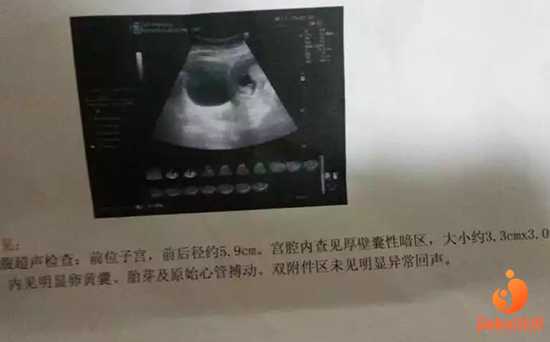 广州有哪些供卵的地方,广州能做供卵试管公立的医院有哪些？全国排名试管婴