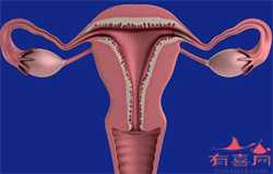 深圳有子宫肌瘤代孕，深圳女人坐月子食谱禁忌有哪些