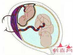 深圳做代孕多少钱，深圳北大医院做试管婴儿要花多少钱？