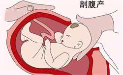 找云南女人代生孩子,云南正规医院卵子库卵子多少钱？附2022供卵三代生男孩费